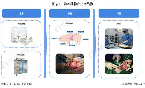 重大里程碑 科學(xué)家首次將豬肝移植到人體，成功過(guò)濾血液72小時(shí)，計(jì)算機(jī)軟硬件技術(shù)開(kāi)發(fā)的關(guān)鍵作用